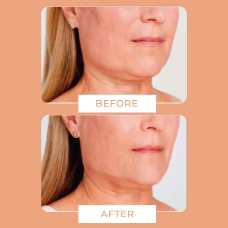 i-Face Esthetic